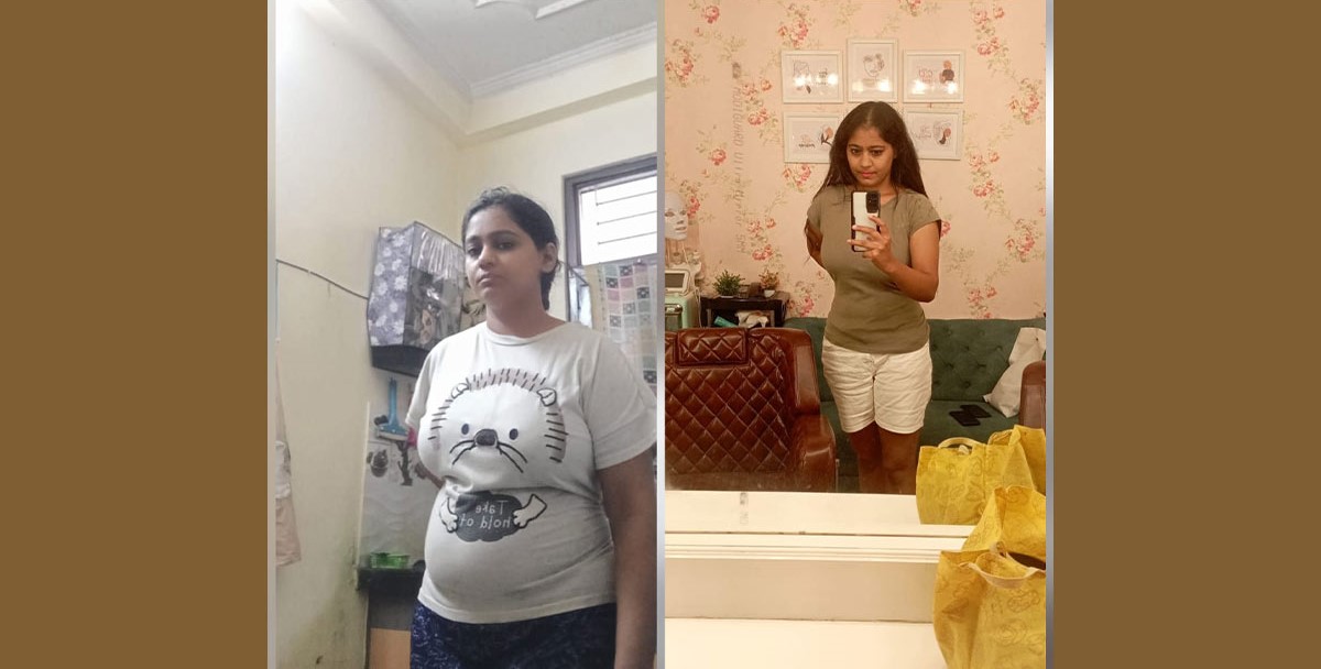 weight-loss-true-story