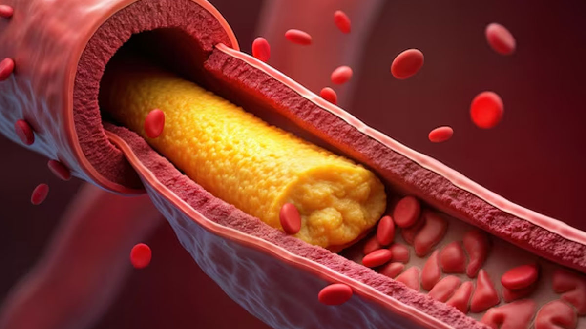 does drinking turmeric milk increase cholesterol in hindi 01 (5)