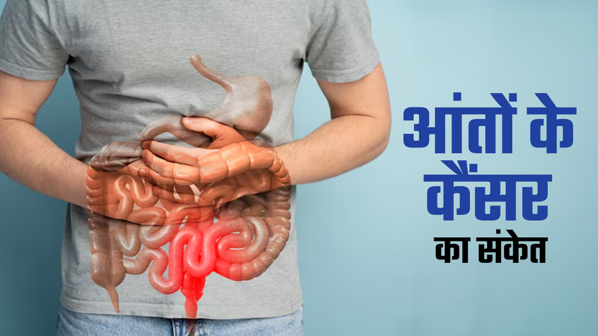 लंबे समय तक रहने वाली गैस की समस्या आंतों के कैंसर का संकेत है? डॉक्टर से जानें