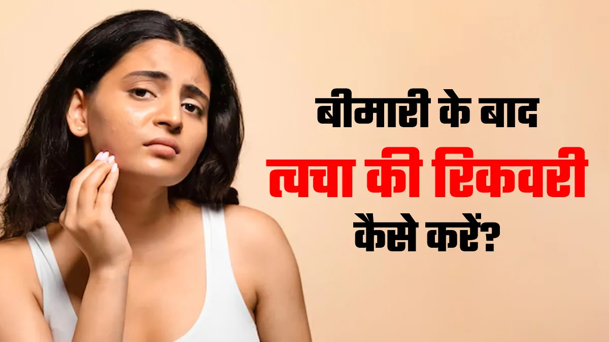 बुखार या बीमारी से मुरझा सकती है त्वचा, डॉक्‍टर से जानें रिकवरी के उपाय
