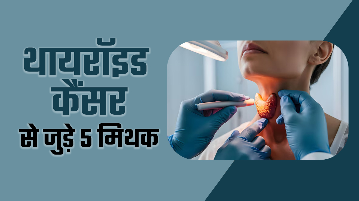 थायराइड कैंसर के इन 5 म‍िथकों पर न करें भरोसा, डॉक्‍टर से जानें इनका सच