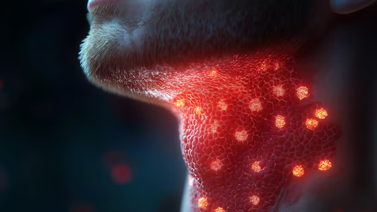 thyroid-cancer-myths