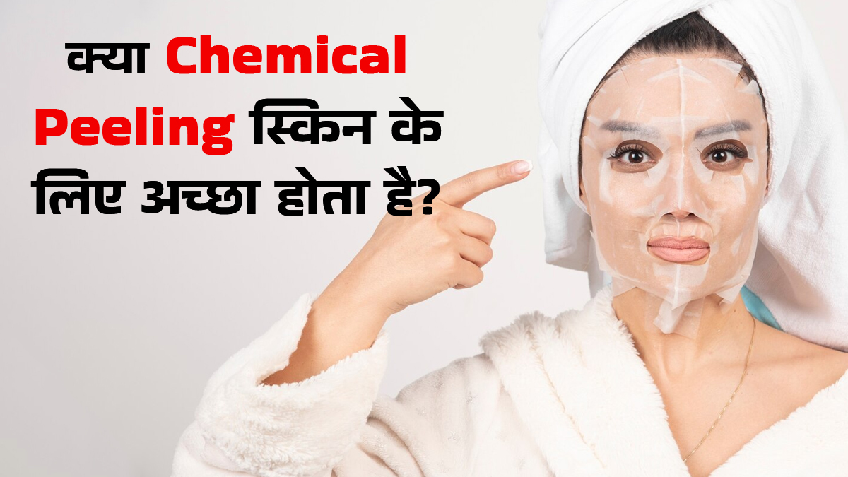 क्या केमिकल पील स्किन के लिए अच्छा होता है? जानें डर्मेटोलॉजिस्ट से फायदे-नुकसान