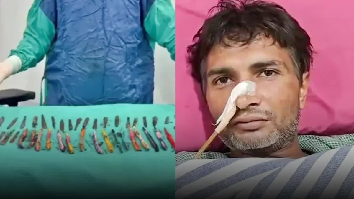 यूपी में अजीब मामला: नशे के आदी युवक ने खा लिए 29 चम्मच, 19 टूथब्रश और पेन, डॉक्टरों ने बचाई जान