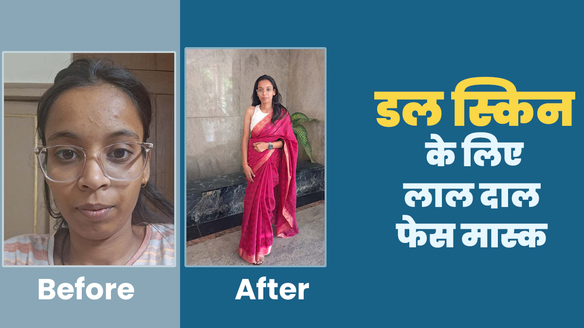 चमकाएं अपनी डल स्किन! दीपशिखा की तरह लगाएं हैं लाल दाल का फेस मास्क, जानें इस्तेमाल का तरीका
