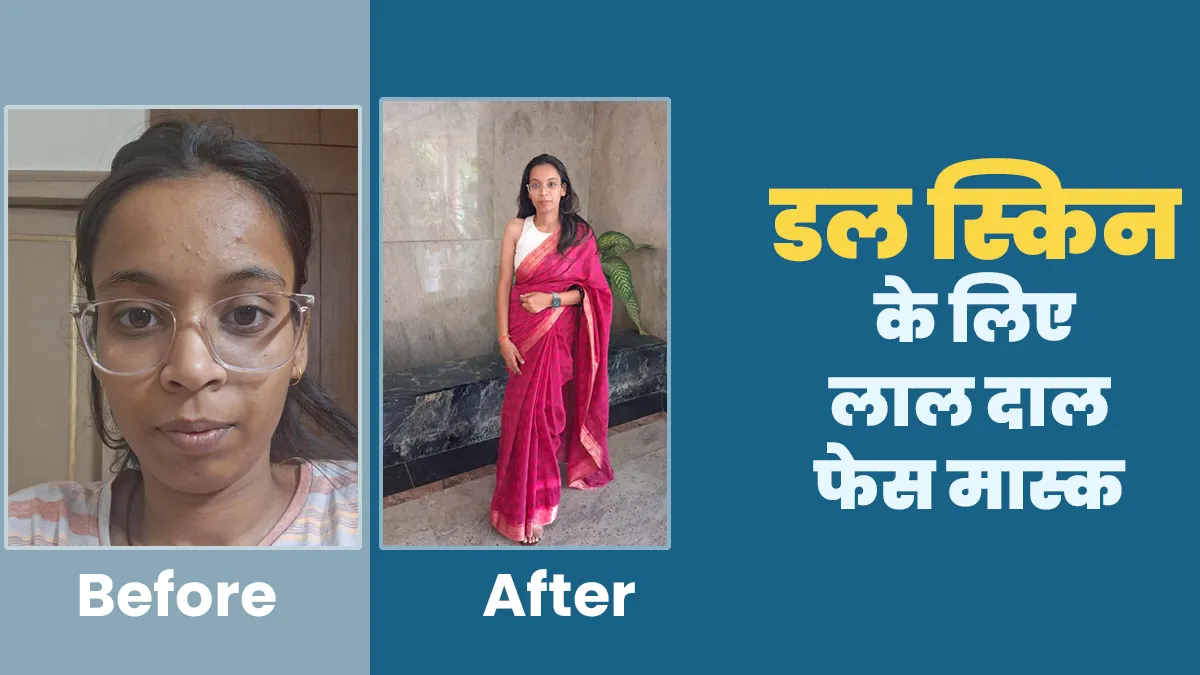 चमकाएं अपनी डल स्किन! दीपशिखा की तरह लगाएं हैं लाल दाल का फेस मास्क, जानें इस्तेमाल का तरीका