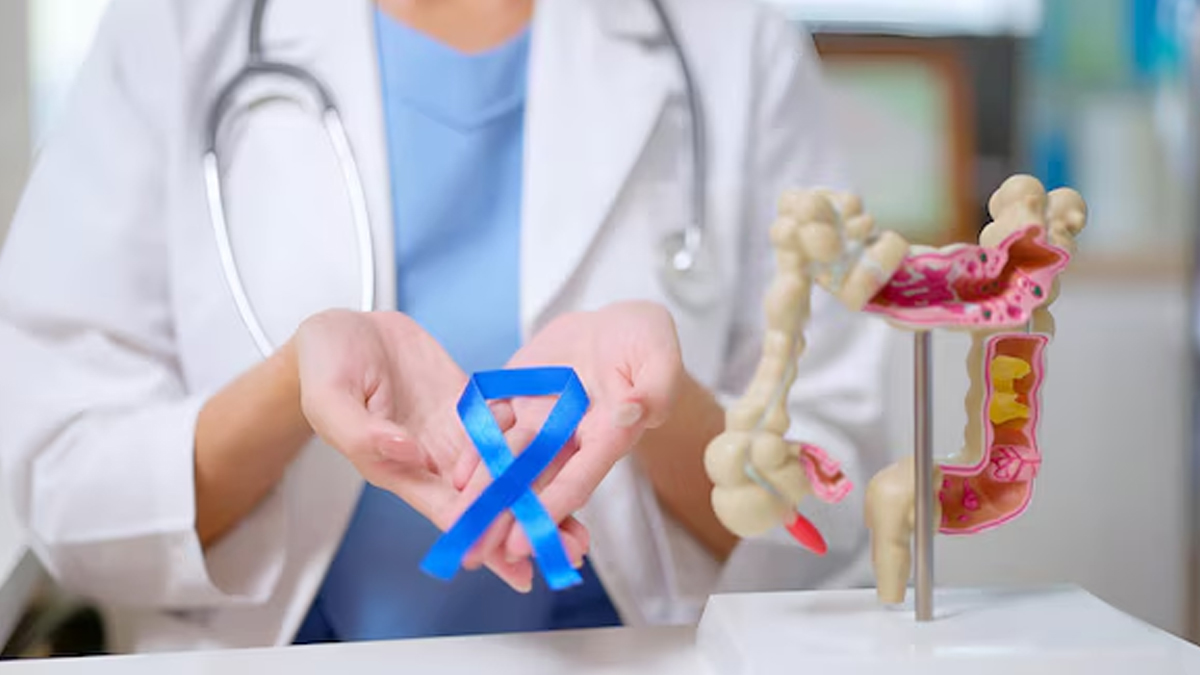 is constipation linked to colon cancer