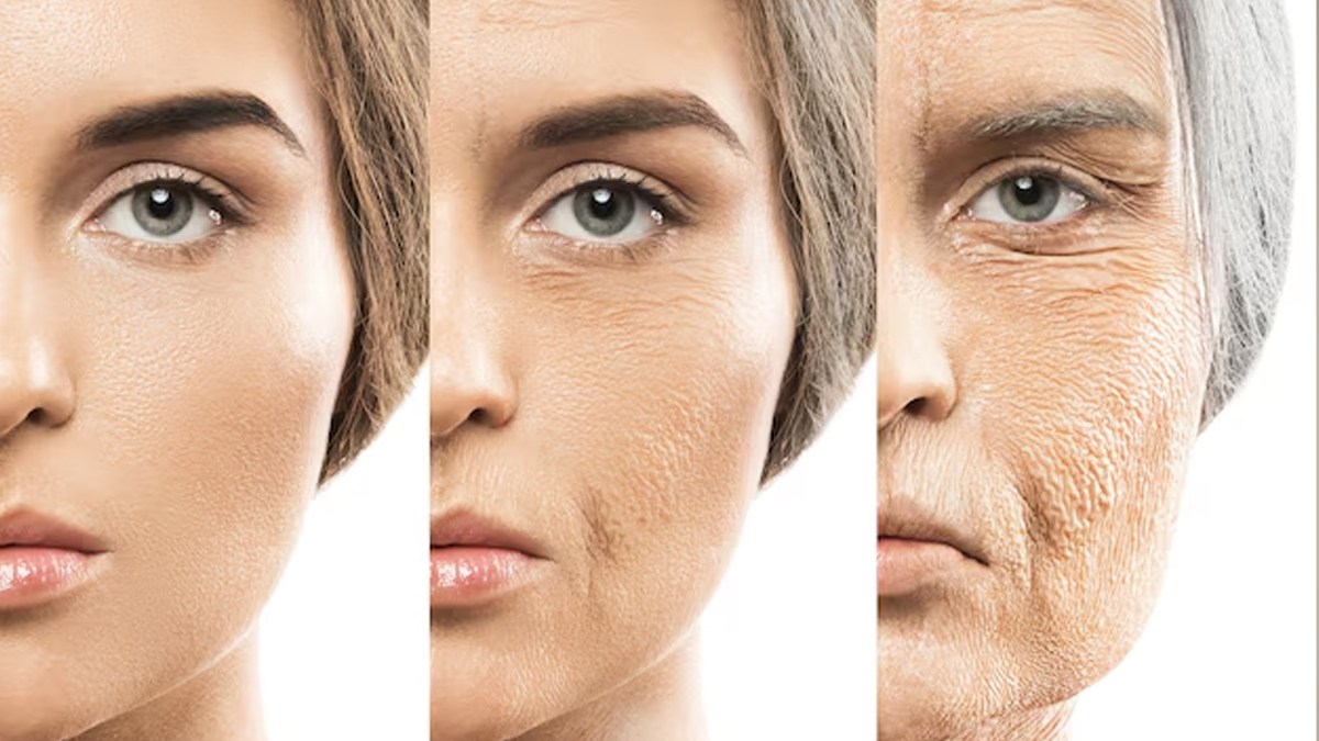 women-skin-aging-faster-than-man