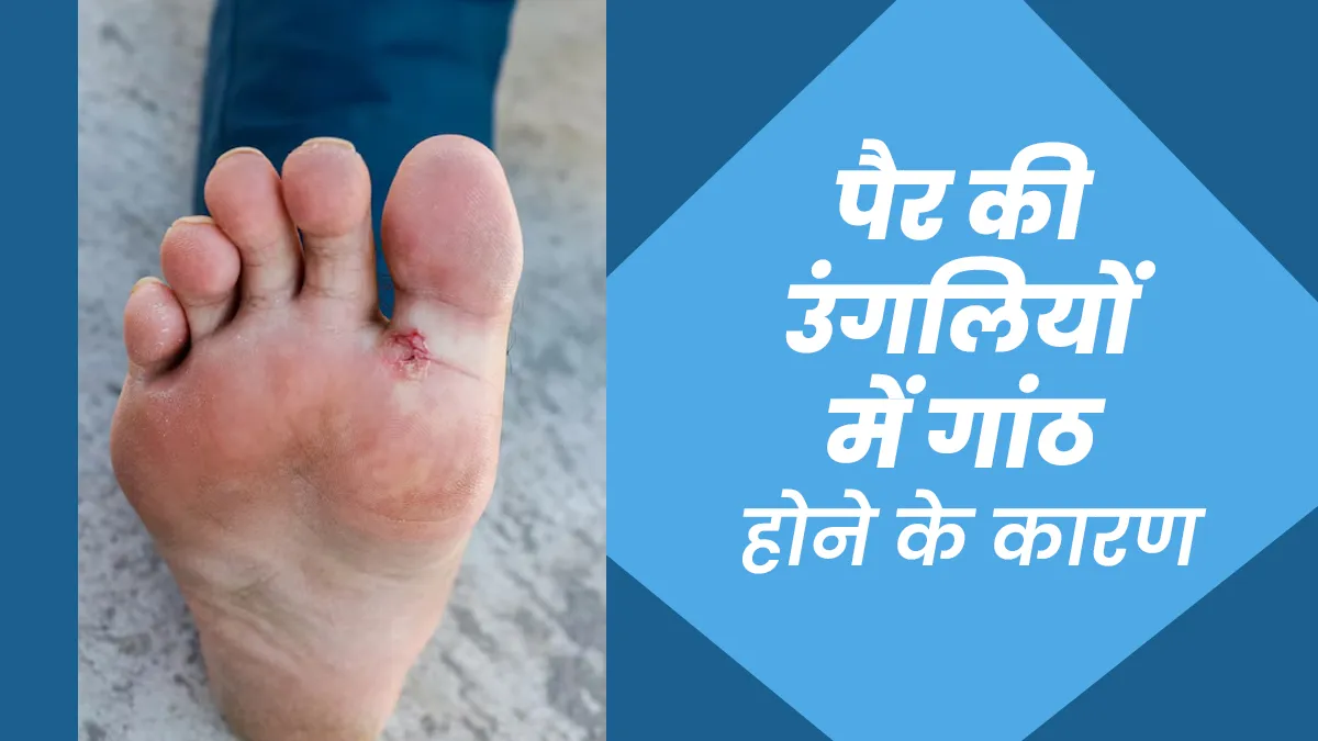 पैर की उंगलियों में गांठ होने का क्या कारण है? डॉक्टर से जानें