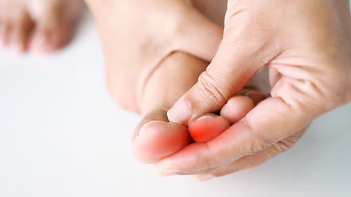 lumps-on-toes-in-hindi-inside