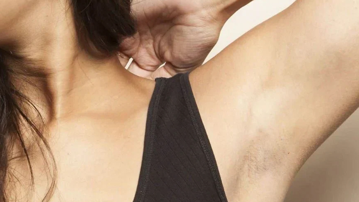 underarm-home-remedy-dark-spots