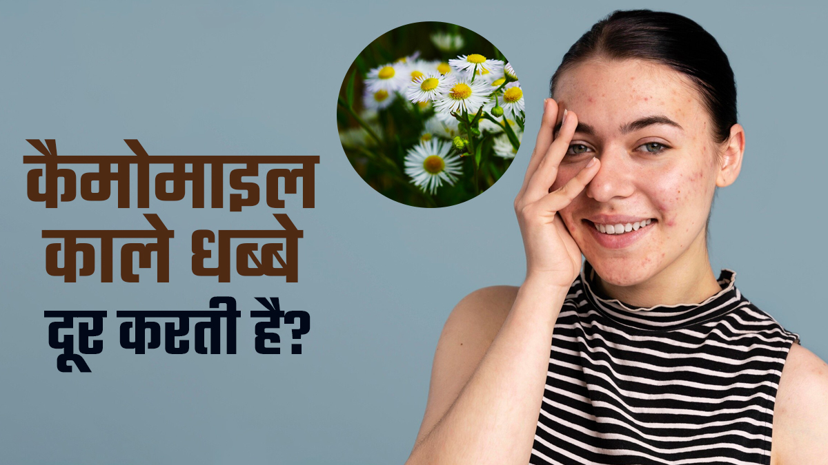 क्या कैमोमाइल काले धब्बे दूर करती है? एक्सपर्ट से जानें पिग्मेंटेशन में ये कितना कारगर 
