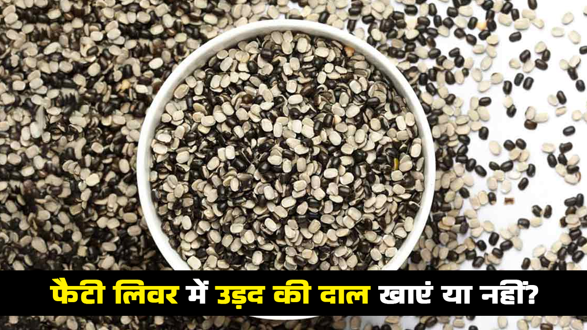 क्या फैटी लिवर होने पर उड़द की दाल खा सकते हैं? एक्सपर्ट से जानें