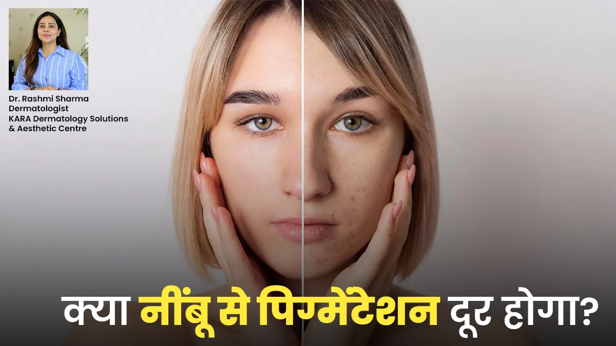 क्या नींबू से पिग्मेंटेशन की समस्या सच में दूर होती है? डर्मेटोलॉजिस्ट से जानें