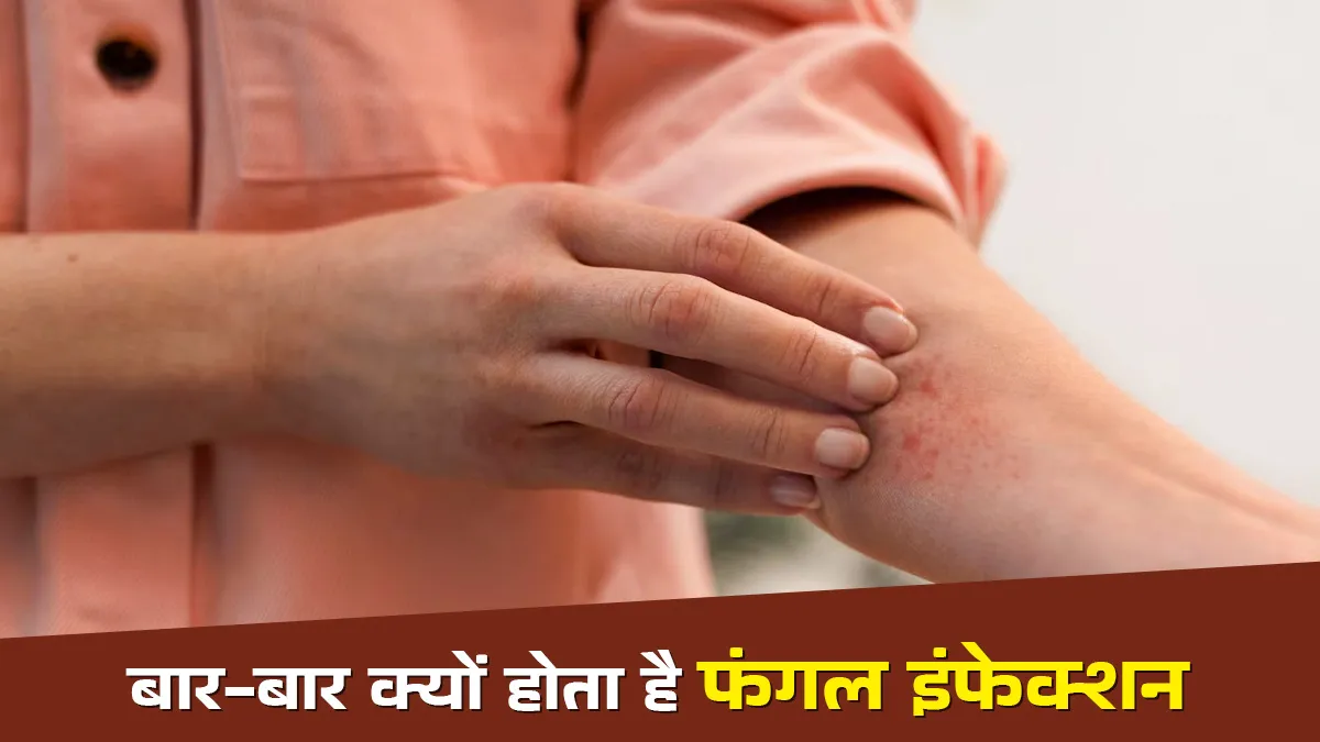 बार-बार होने वाले फंगल इन्फेक्शन का क्या कारण है? खुद एक्सपर्ट ने बताया