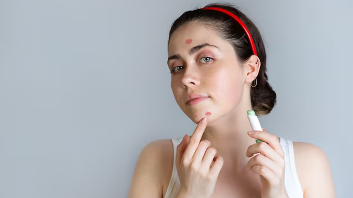 Chamomile benefits for dark spots