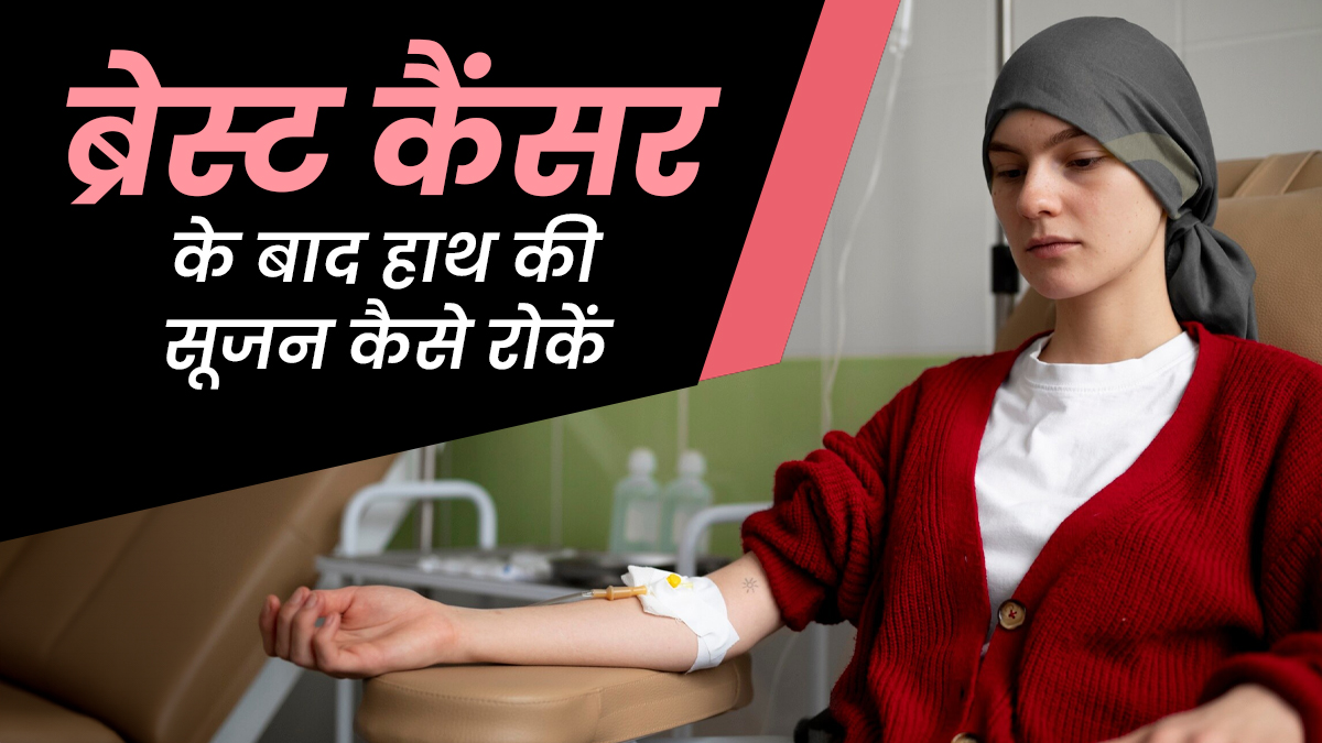 ब्रेस्ट कैंसर के बाद हाथों की सूजन से कैसे करें बचाव? जानें डॉक्टर की सलाह