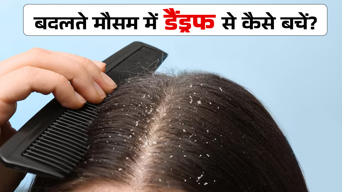 बदलते मौसम में हो सकती है डैंड्रफ की श‍िकायत, एक्‍सपर्ट से जानें बचाव के उपाय
