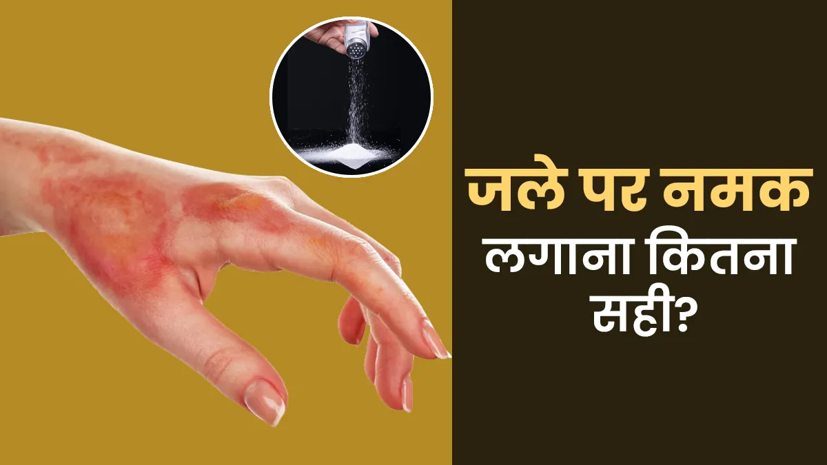 क्या सच में जले पर नमक लगाना होता है फायदेमंद? जानें क्या कहता है विज्ञान