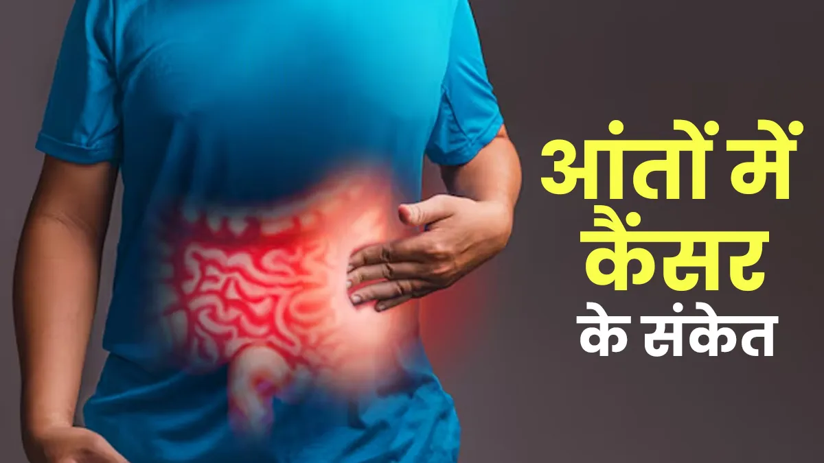 आंतों के कैंसर के चेतावनी संकेत क्या हैं? डॉक्टर से जानें