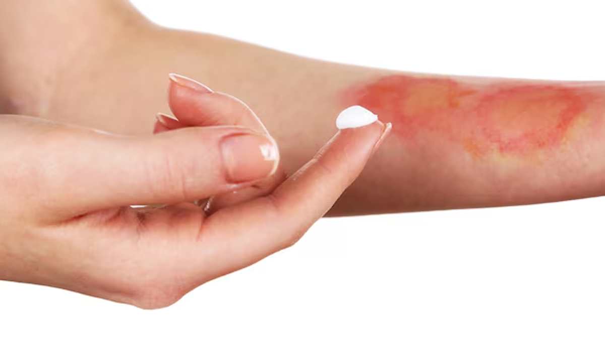 jale-par-namak-lagane-se-kya-hota-hai-inside