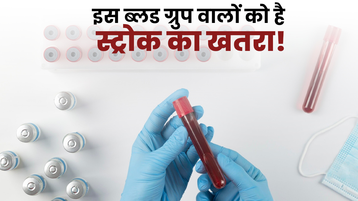 किस ब्लड ग्रुप को स्ट्रोक का खतरा ज्यादा है? ये स्टडी बता रही है इस सवाल का जवाब