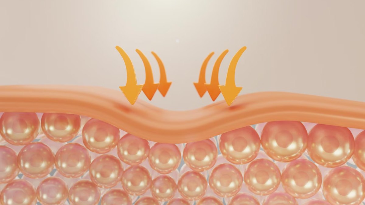 What are skin Skin barriers