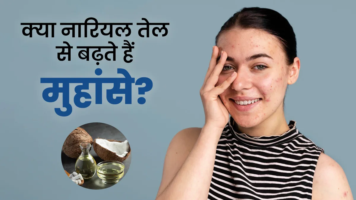 क्या नारियल तेल से पोर्स बंद होकर मुंहासे बढ़ते हैं? जानें डर्मेटोलॉजिस्ट से
