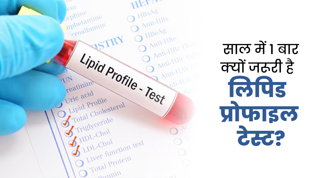 साल में 1 बार जरूर करवाना चाह‍िए लिपिड प्रोफाइल टेस्ट, डॉक्‍टर ने बताए फायदे