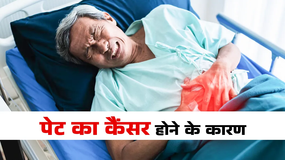 क‍िसी भी उम्र में हो सकता है पेट का कैंसर, डॉक्‍टर ने बताए इसके 5 जोखिम कारक