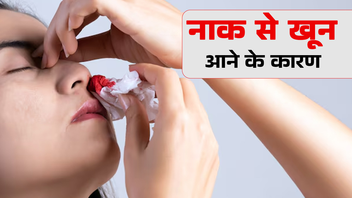 आपके भी नाक से निकलता है खून? डॉक्टर से जानें इसके कारण