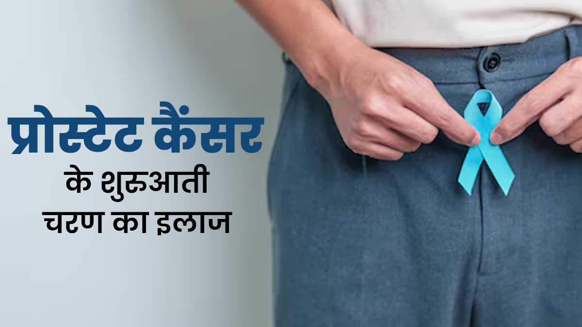 स्‍टेज 1 प्रोस्‍टेट कैंसर का इलाज क्‍या है? डॉक्‍टर से जानें