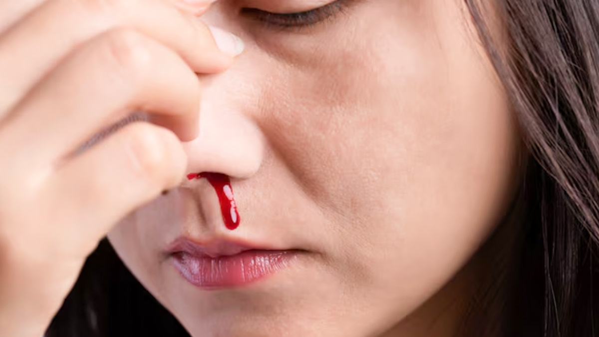 nose-bleeding-in-adults-inside
