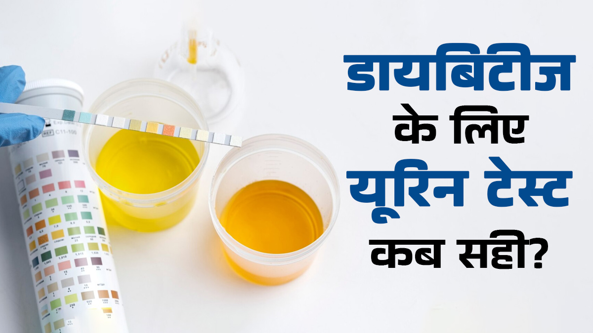 डायबिटीज जांच के लिए कब कराएं यूरिन टेस्ट? जानें सही समय और तैयारी
