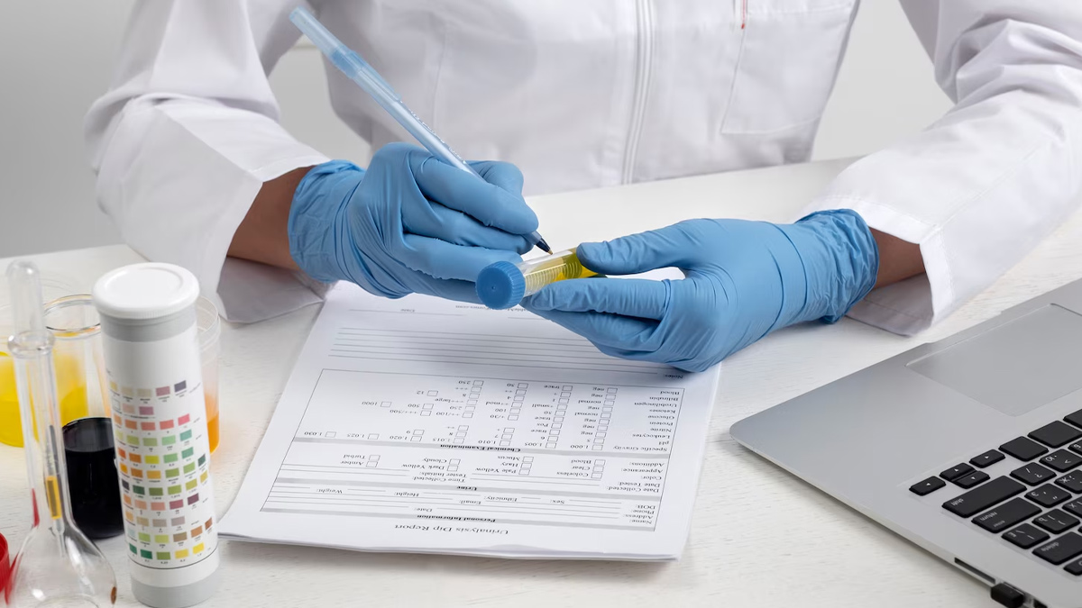 best time to do a urine test for diabetes
