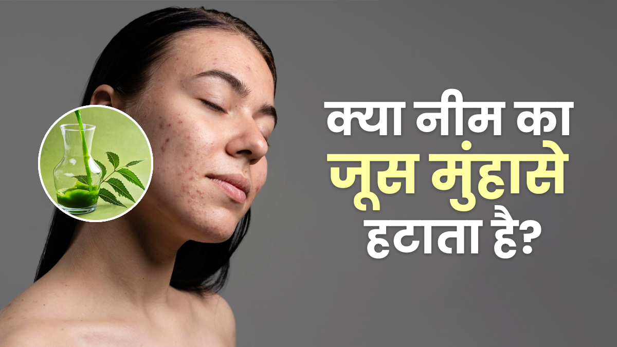 क्या नीम का जूस मुंहासों को दूर करता है? आयुर्वेदाचार्य से जानें