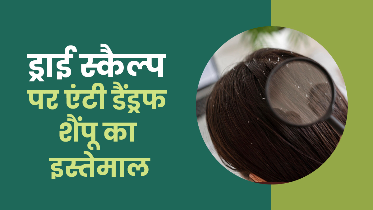 अगर मेरा स्कैल्प ड्राई है तो क्या मुझे एंटी-डैंड्रफ शैंपू का इस्तेमाल करना चाहिए? एक्सपर्ट से जानें इस सवाल का जवाब