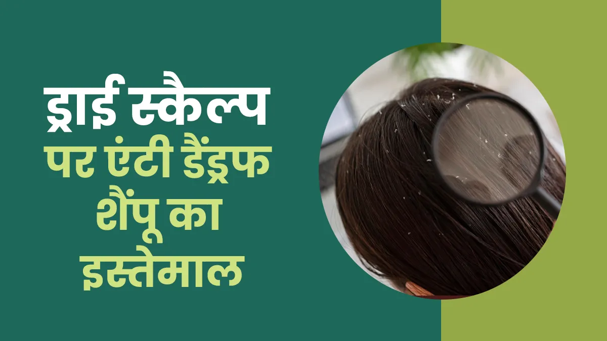 अगर मेरा स्कैल्प ड्राई है तो क्या मुझे एंटी-डैंड्रफ शैंपू का इस्तेमाल करना चाहिए? एक्सपर्ट से जानें इस सवाल का जवाब