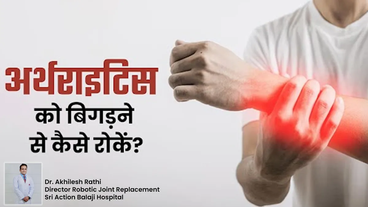 अर्थराइटिस को बिगड़ने से कैसे रोकें? अपनाएं एक्सपर्ट के बताए ये 5 टिप्स