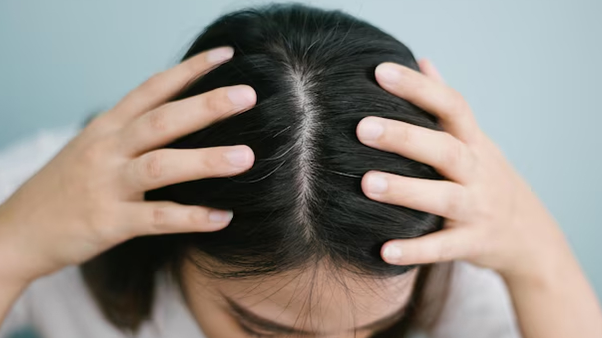 how-does-cold-weather-affect-scalp