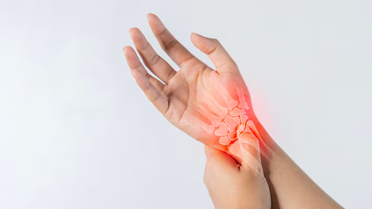 how to prevent arthritis from getting worse 01 (10)