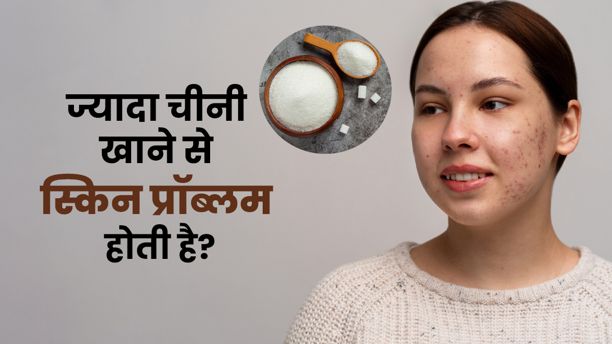 चीनी का ज्यादा सेवन स्किन से जुड़ी इन समस्याओं का बन सकता है कारण, जानें