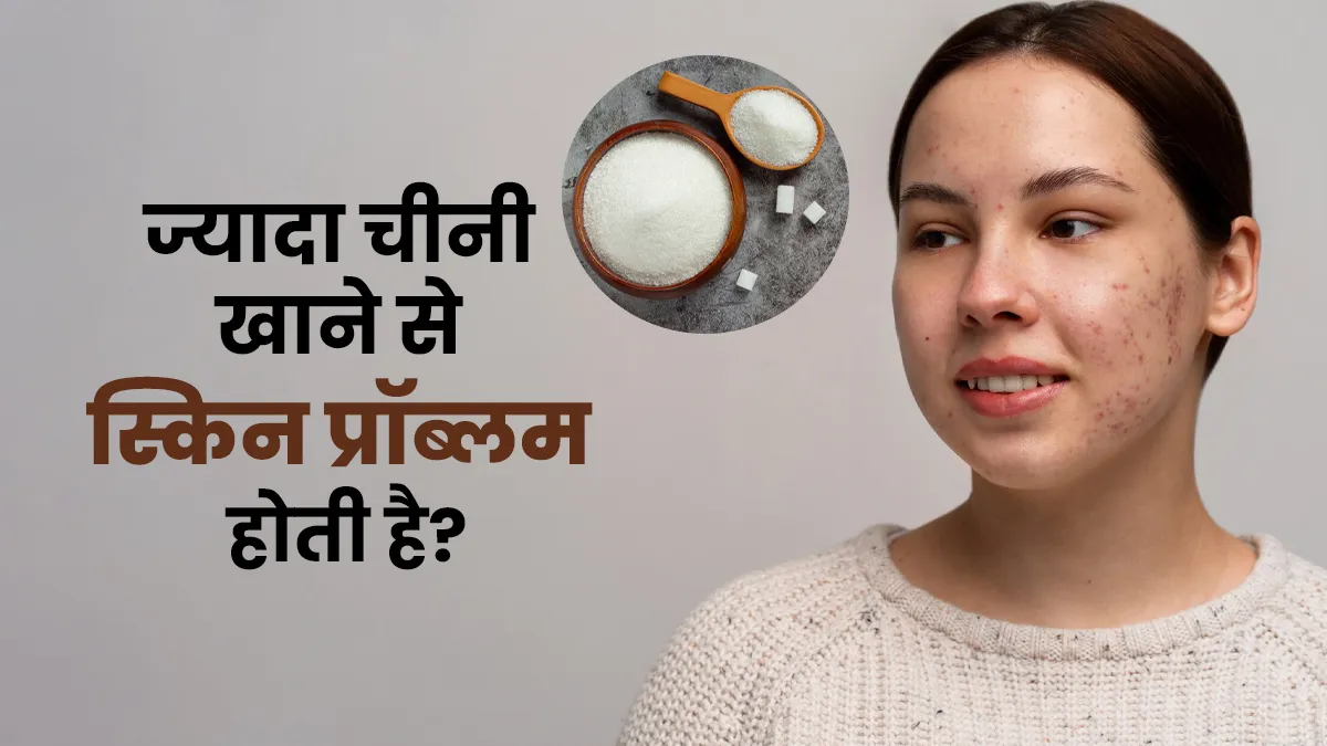 चीनी का ज्यादा सेवन स्किन से जुड़ी इन समस्याओं का बन सकता है कारण, जानें