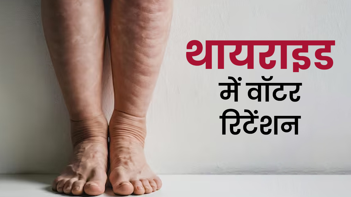 थायराइड में वॉटर रिटेंशन ज्यादा होता है? डॉक्टर से जानें