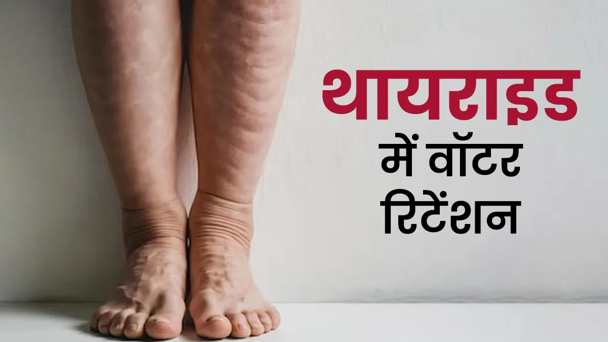 थायराइड में वॉटर रिटेंशन ज्यादा होता है? डॉक्टर से जानें