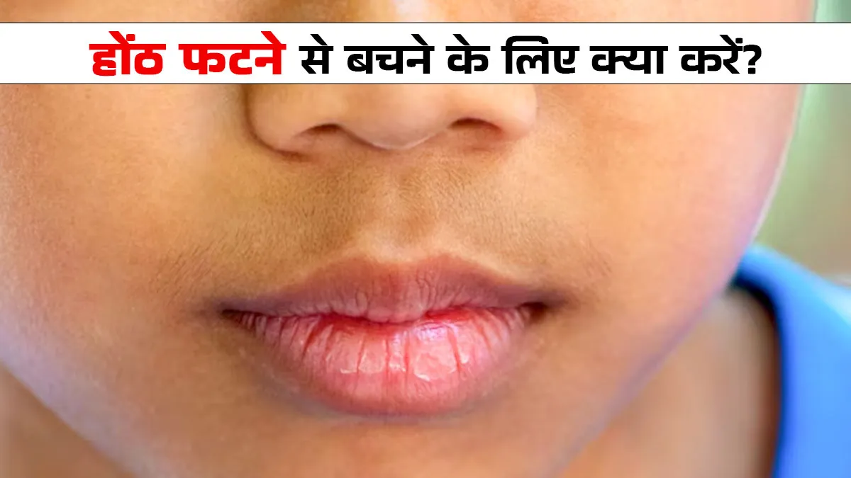 बदलते मौसम में फटे होंठों की समस्या से हैं परेशान तो इन टिप्स की मदद से करें बचाव