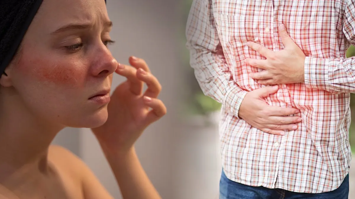 Leaky gut syndrome: स्किन में नजर आते हैं लीकी गट सिंड्रोम के ये लक्षण, डॉक्टर से जानें क्या है ये