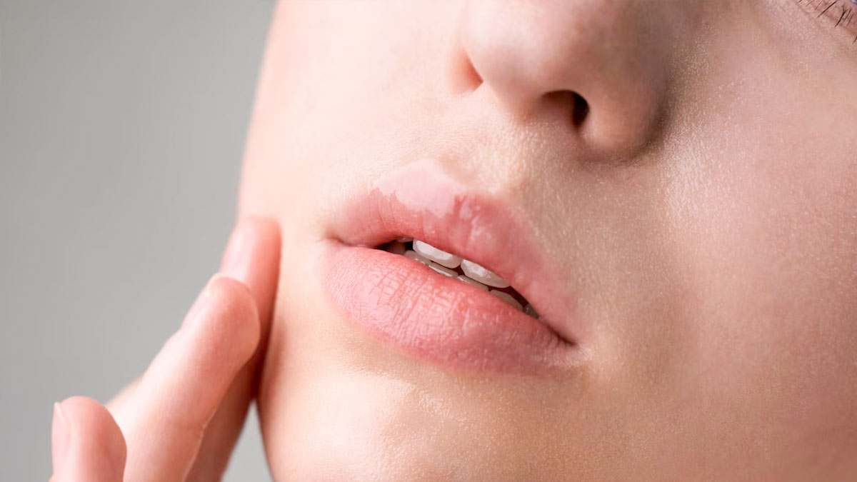 Tips-to-prevent-chapped-lips-inside