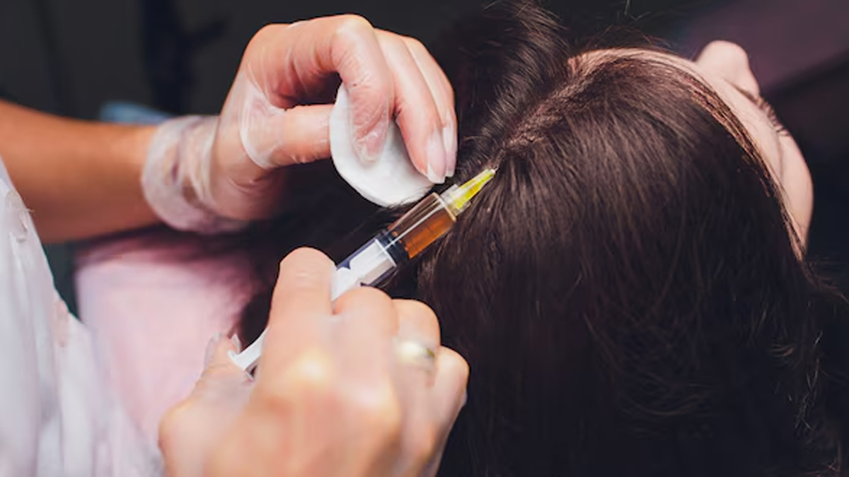 treatment for hair thinning