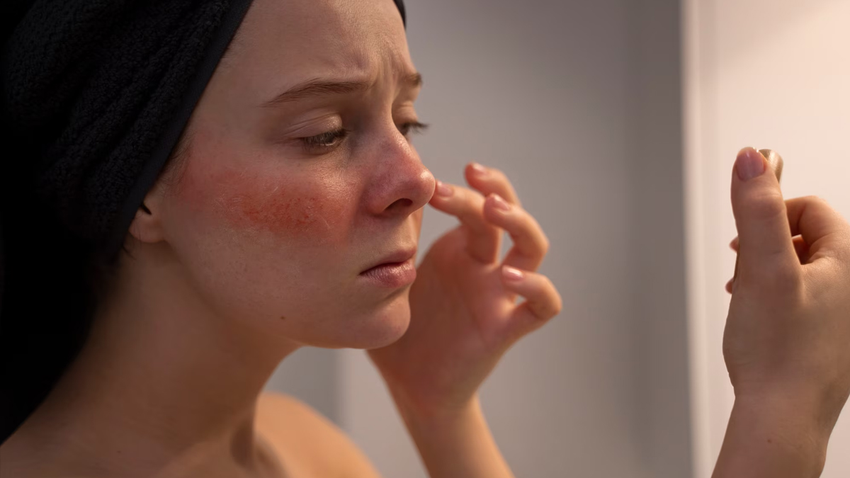 how to treat irritated skin